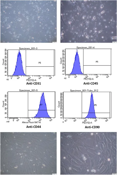 Frontiers | Effect of injecting adipose stem cells combined with