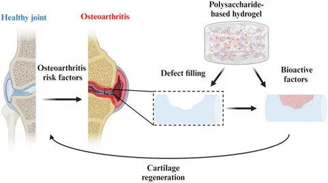 SA Removal of Phosphate from Water by Iron/Calcium Oxide
