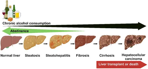 Frontiers | Betaine regulates the gut-liver axis: a