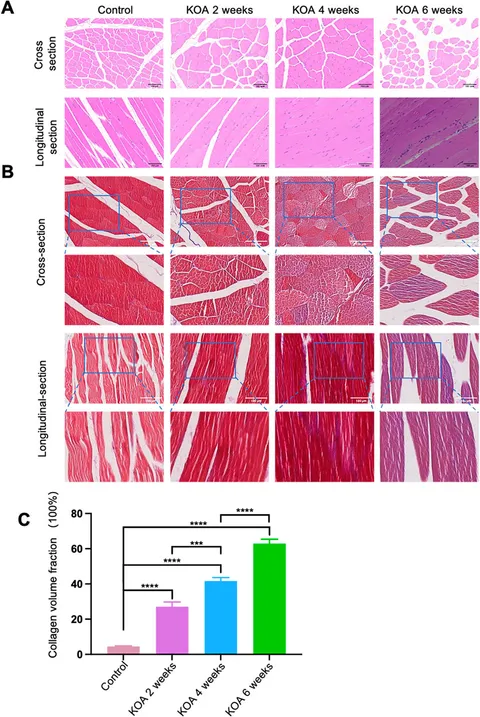 逆輸入 Frontiers | Characterization of rectus femoris lesions in その他