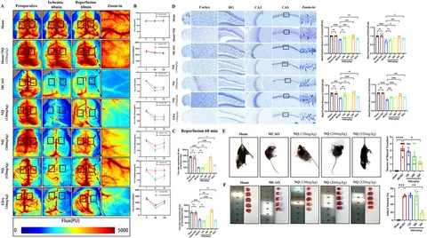 専用 Eと? A cantilever-structure triboelectric nanogenerator for