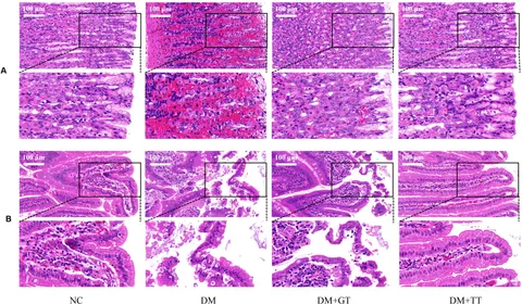 Frontiers | Long-term tuina can inhibit the occurrence of