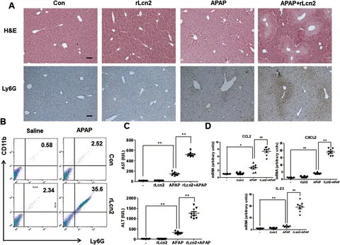 Frontiers | Chitinase 3-like protein 1 deficiency