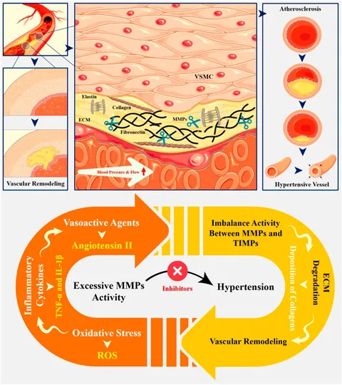 Frontiers | Metalloproteinases (MMPs) in hypertensive