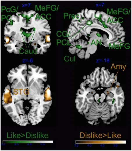 Frontiers | It's Sad but I Like It: The Neural Dissociation