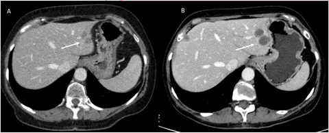 Frontiers | Treatments and cancer: implications for radiologists