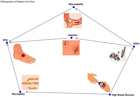 Frontiers | Skin microbiota and diabetic foot ulcers