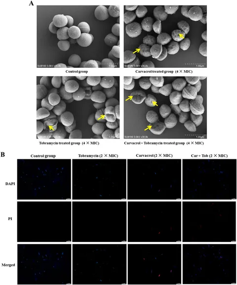 その他 et nu SEM observation of S. aureus ATCC 25923, before (A) and