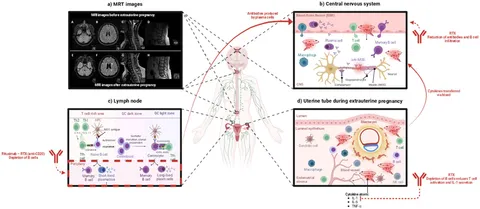 写真まとめ② Frontiers | Case report on severe myelin oligodendrocyte
