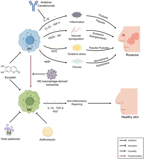 Frontiers | Macrophages in rosacea: pathogenesis and