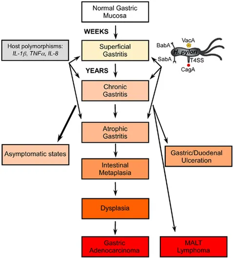j-t Liquid biopsy in gastric cancer: predictive and prognostic