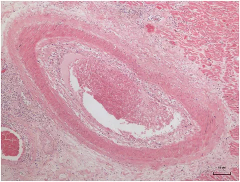 fcvm-03-00030-g001.jpg