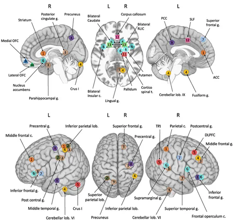 Clinical Neuroanatomy: Brain Circuitry and Its Disorders