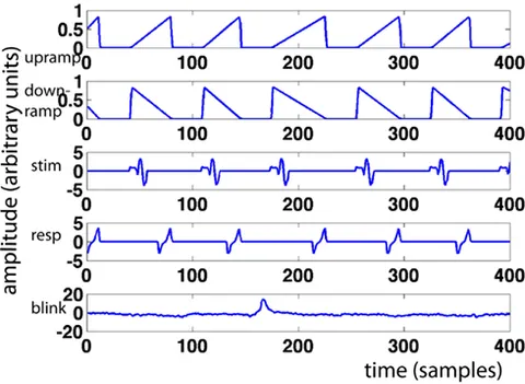 eeg 2008年 Electroencephalogram (EEG) state segmentation and decoding