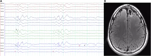 fneur-08-00499-g014.jpg