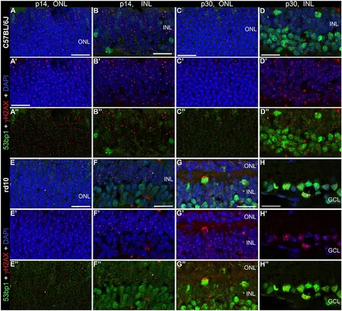 Frontiers | Detection of DNA Double Strand Breaks by γH2AX