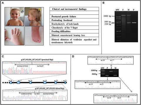 A Novel Biomarker Identifies Systemic Lupus Erythematous