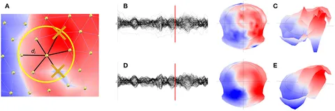 Frontiers | EEG Source Imaging: A Practical Review of the Analysis