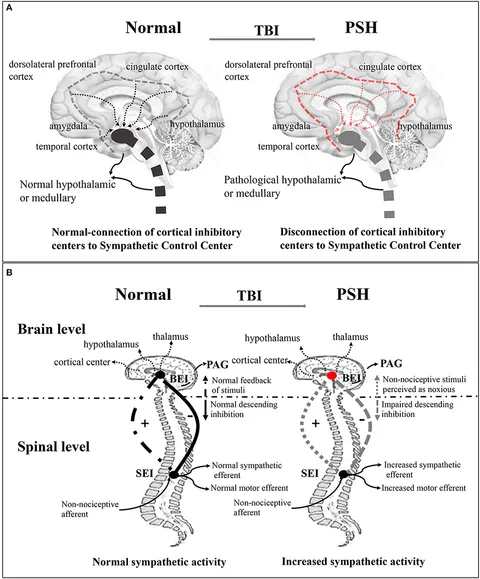 Frontiers | Identification and Management of Paroxysmal