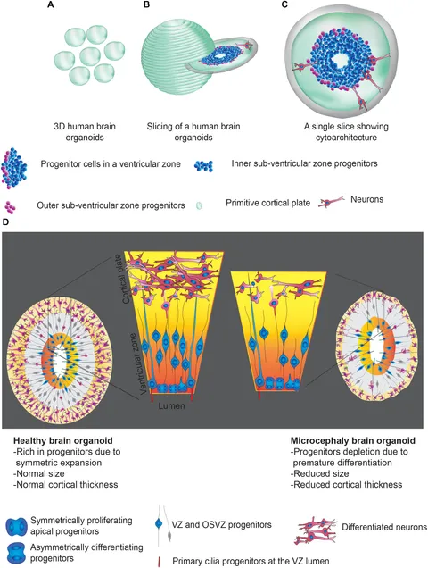 Frontiers | Human Brain Organoids to Decode Mechanisms of Microcephaly
