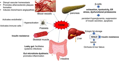 独特の素材 Diabetes 2 Type of Effects The | Frontiers Mellitus Organ on 旅行かばん・小分けバッグ