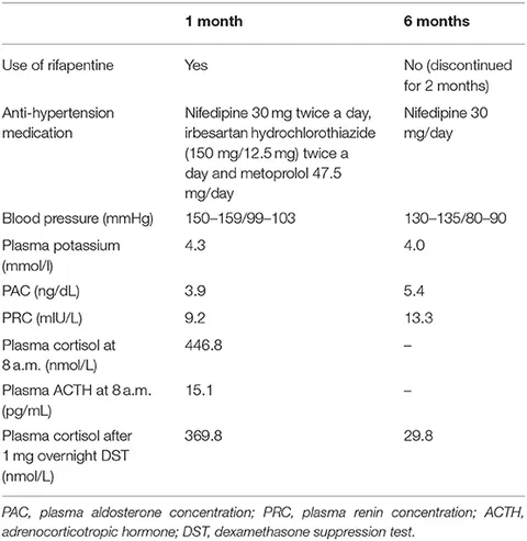 S&amp;L Stinger SGP901351 135 Amp Circuit Breaker - Sonic Electronix