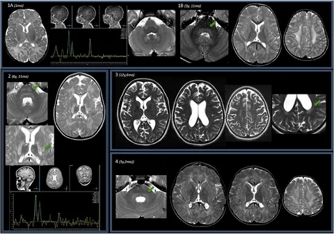 【裁断済】小児神経の画像診断 = Diagnostic Imaging of I 裁断済 小児神経の画像診断 改訂第2版 Diagnostic Imaging-通販