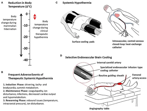 Frontiers | Selective Brain Hypothermia in Acute Ischemic