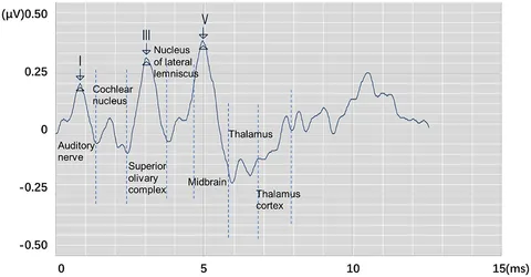 の Exosomes in the Diagnosis of Neuropsychiatric Diseases: A Review