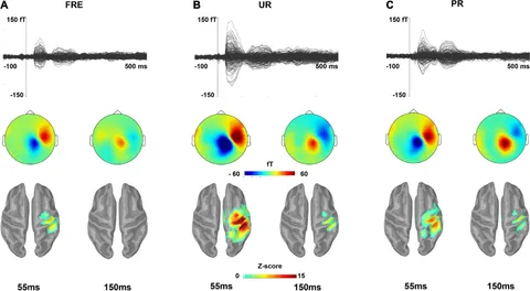 特撮 Cognitive Neuroscience The Human Connectome Project of adolescent anxiety and