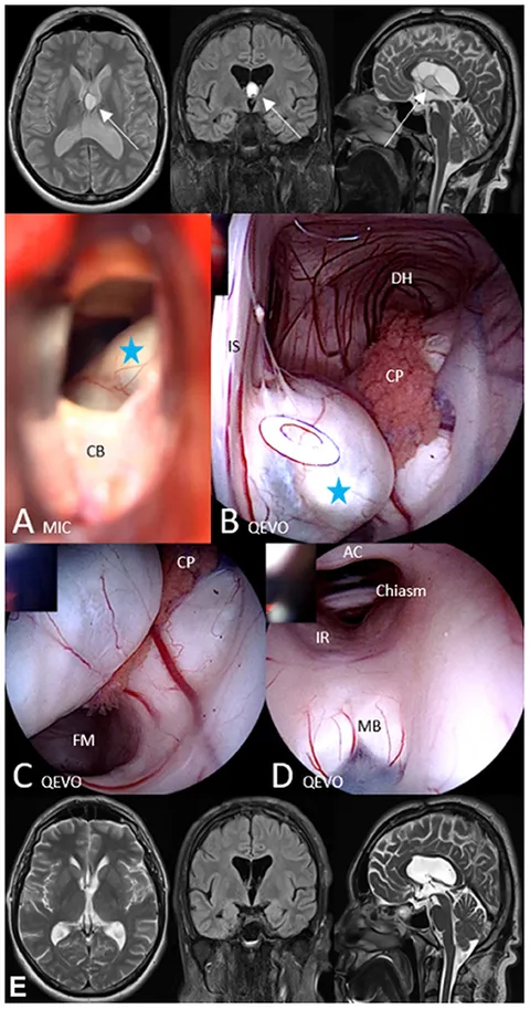 fsurg-08-648853-g003.jpg
