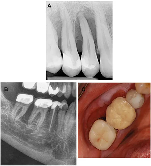 fdmed-02-687510-g003.jpg