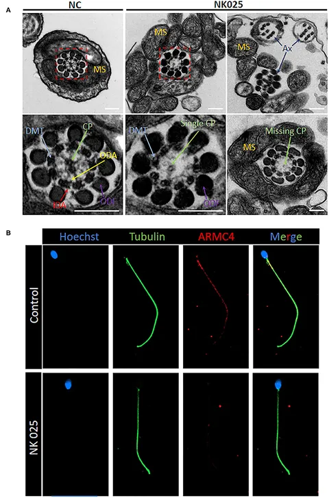 Germinal centres with corresponding patterns of follicular