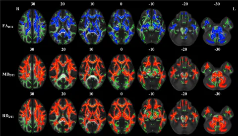 Frontiers | Diffusion tensor imaging and white matter