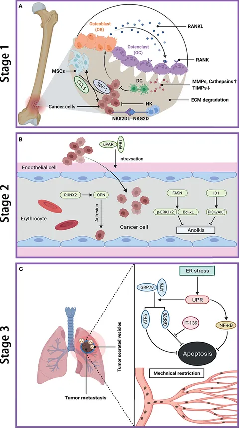 Frontiers | Osteosarcoma and Metastasis