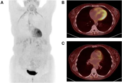 K Frontiers | A Clinical Approach to Multimodality Imaging in