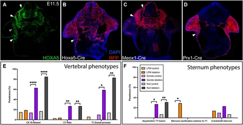 高価値 Frontiers | Hoxa5 Activity Across the Lateral Somitic スーツ