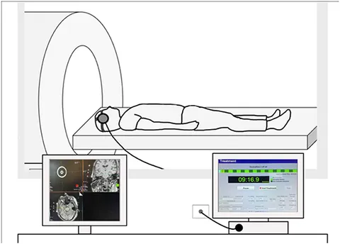 健康・医学 Focused Ultrasound Techniques Focused Ultrasound Techniques for the Small Animal