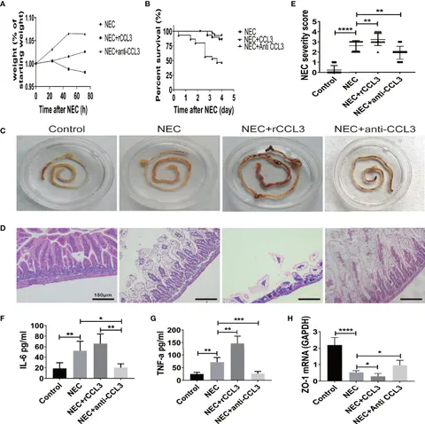 Frontiers | Novel Therapeutic Targeting of CCL3-CCR4 Axis