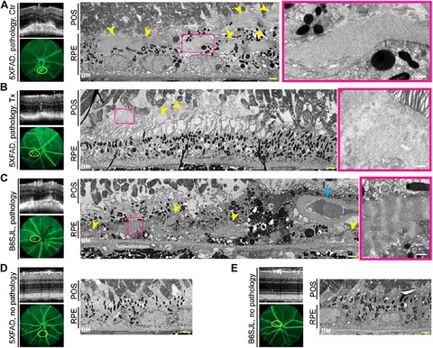 Diallyl Disulfide Induces Chemosensitization to Sorafenib