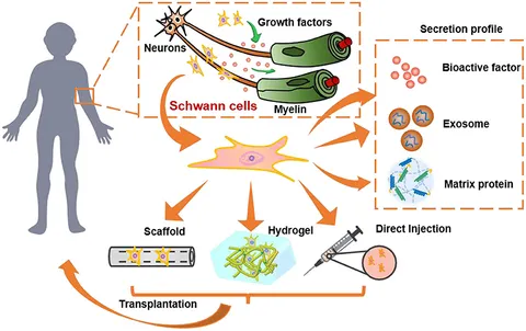 Frontiers | Biomaterial-Based Schwann Cell Transplantation