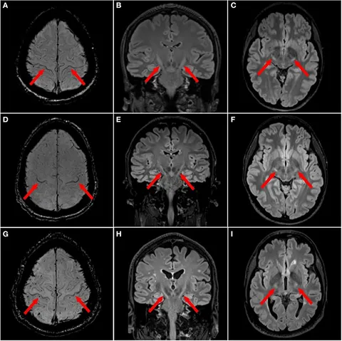 Porno video kamming ong mushuk Porno video kamming ong mushuk