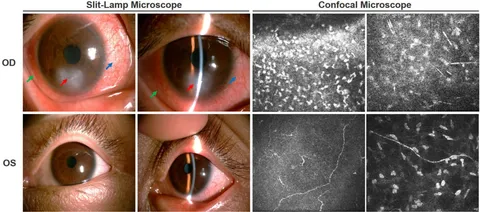 健康・医学 OPATHY FOR ANGER AND MORTIFICATION Frontiers | White matter and gray matter changes related to