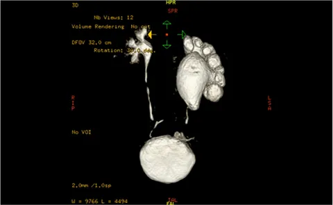 尿路変向・再建術 (Urologic Surgery Next 5) | 荒井 陽一 |本