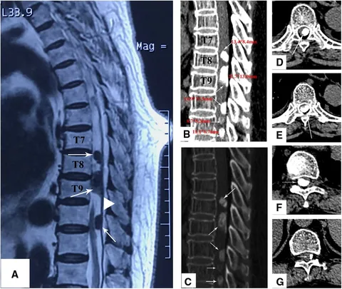 健康・医学 Spinal control Nevro trumpets positive data from pivotal study of chronic