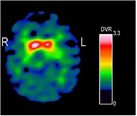moral Genome-Wide Identification and Expression Analysis of ent