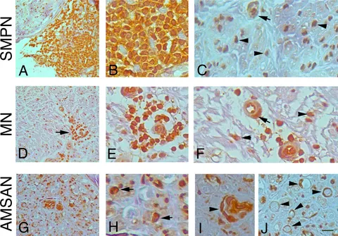 Frontiers | Clinical and pathological findings in