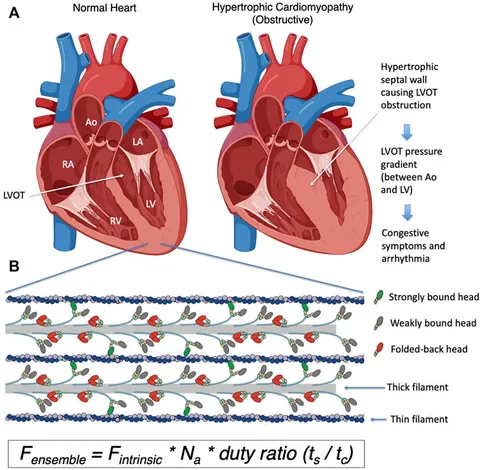 Frontiers | Hypertrophic cardiomyopathy: Mutations to