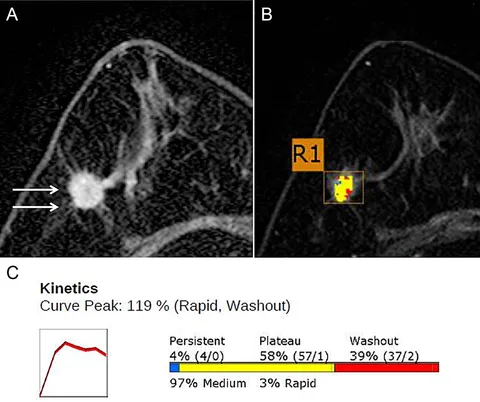 Diagnostic Breast Imaging 第2版 4 key trends in breast imaging